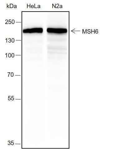 Anti-Human/Rat/Mouse MSH6 Antibody [A308]