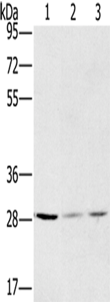 Anti-Human/Mouse/Rat HSD17B12 Antibody - ABMIUM