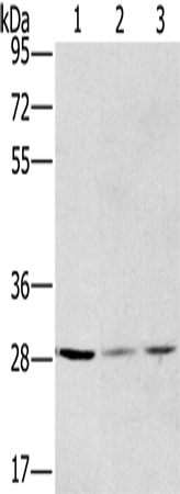 Anti-Human/Mouse/Rat HSD17B12 Antibody - ABMIUM