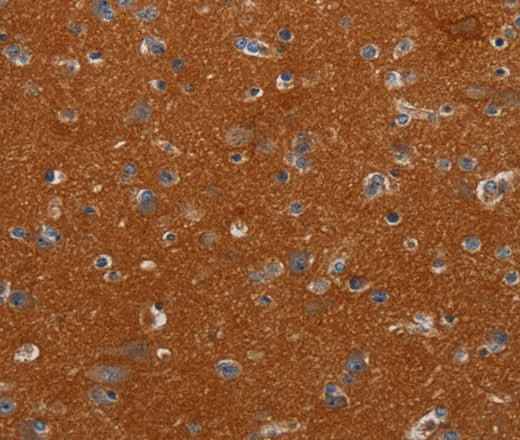Anti-Human NOX3 Antibody