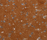 Anti-Human NOX3 Antibody - ABMIUM