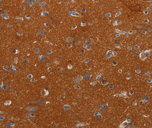 Anti-Human NOX3 Antibody - ABMIUM