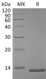 Recombinant Mouse S100A4 Protein (His Tag) - ABMIUM