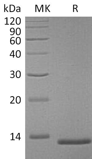 Recombinant Mouse S100A4 Protein (His Tag) - ABMIUM