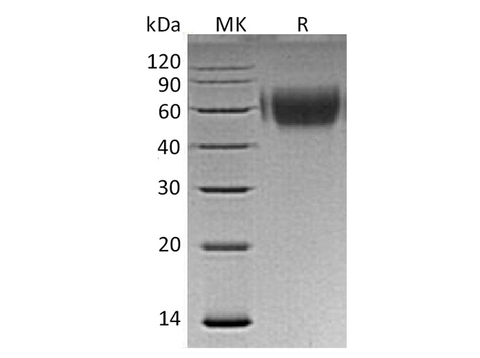 Recombinant Human MICA Protein (His Tag) - ABMIUM