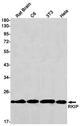 Western blot detection of RKIP in Rat Brain,C6,3T3,Hela cell lysates using RKIP Rabbit mAb(1:1000 diluted).Predicted band size:40kDa.Observed band size:40kDa.