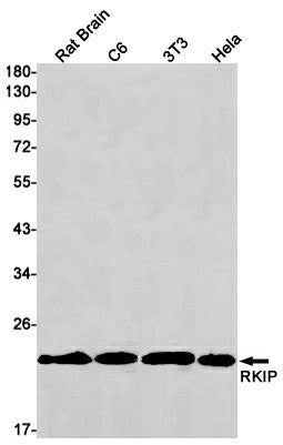 Western blot detection of RKIP in Rat Brain,C6,3T3,Hela cell lysates using RKIP Rabbit mAb(1:1000 diluted).Predicted band size:40kDa.Observed band size:40kDa.