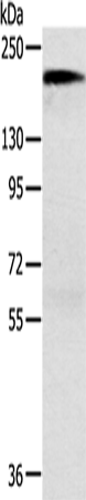 Anti-Human/Mouse/Rat ACE Antibody - ABMIUM