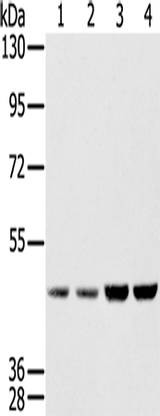 Anti-Human SSB Antibody - ABMIUM