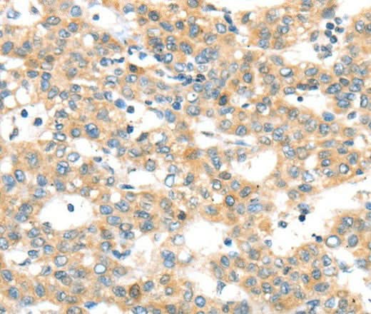 Anti-Human/Mouse RAB24 Antibody - ABMIUM