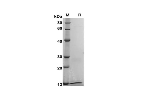 SDS-PAGE analysis of Mouse S100A15/S100A7A proteins, 2 μg/lane of Recombinant Mouse S100A15/S100A7A proteins was resolved with SDS-PAGE under reducing conditions, showing bands at 12 kDa.