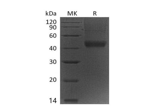 Recombinant Mouse Decorin/DCN Protein (His Tag) - ABMIUM