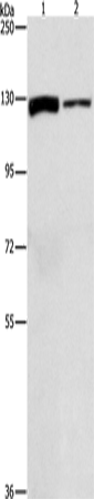 Anti-Human/Mouse/Rat ACLY Antibody - ABMIUM