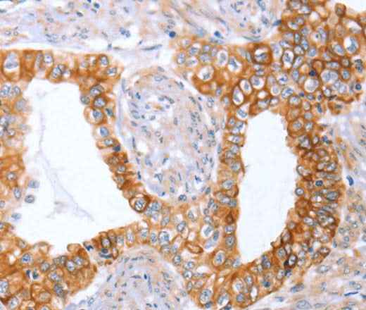 Anti-Human ABO Antibody