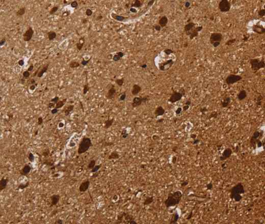 Anti-Human/Mouse/Rat KARS Antibody