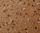 Anti-Human/Mouse/Rat KARS Antibody - ABMIUM