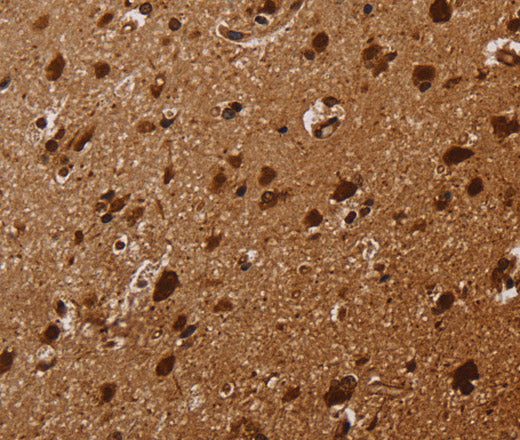 Anti-Human/Mouse/Rat KARS Antibody - ABMIUM
