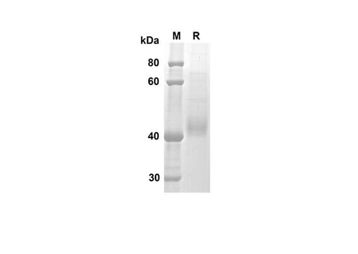 SDS-PAGE analysis of Mouse CTSB proteins, 2 μg/lane of Recombinant Mouse CTSB proteins was resolved with an SDS-PAGE under reducing conditions, showing bands at 34.6 kDa.