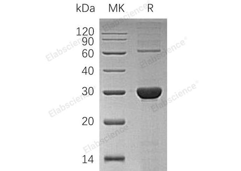 Recombinant Human UROS/UROIIIS Protein (His Tag) - ABMIUM