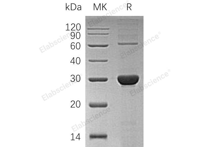 Recombinant Human UROS/UROIIIS Protein (His Tag) - ABMIUM