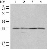 Western blot analysis of 293T Jurkat and 231 cell lysates using COMT Polyclonal Antibody at dilution of 1:350