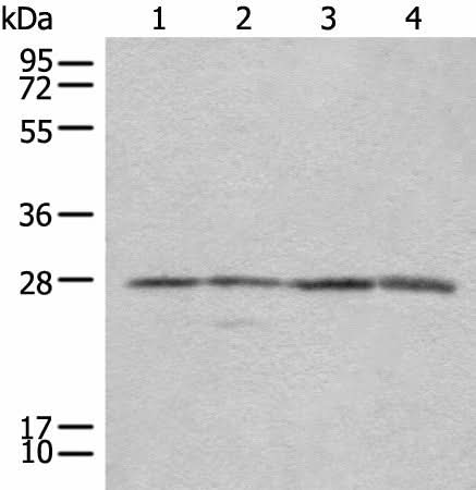 Western blot analysis of 293T Jurkat and 231 cell lysates using COMT Polyclonal Antibody at dilution of 1:350