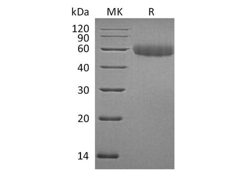 Recombinant Mouse TREML2/TLT2 Protein (His Tag) - ABMIUM