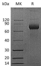 Recombinant Mouse CD38 Protein (Fc Tag) - ABMIUM