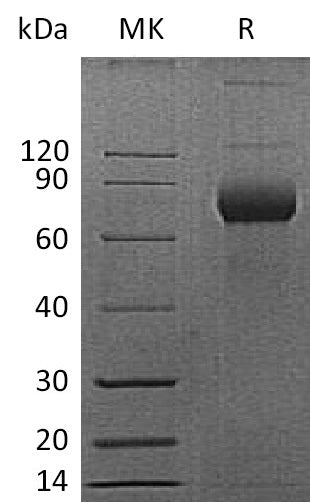 Recombinant Mouse CD38 Protein (Fc Tag) - ABMIUM
