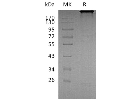 Recombinant Human Cadherin-6/CDH6 Protein (Fc Tag) - ABMIUM