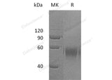 Recombinant Human DR6/TNFRSF21 Protein (Fc Tag) - ABMIUM