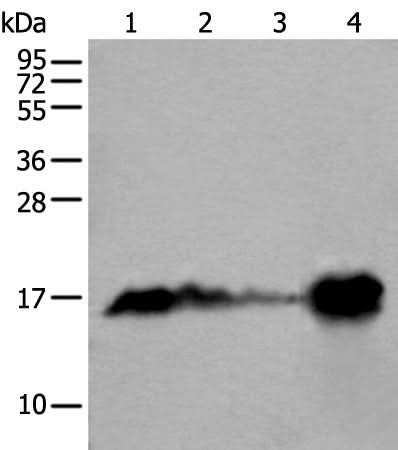Western blot analysis of Human heart tissue Mouse heart tissue Rat heart tissue and Human muscle tissue lysates using MB Polyclonal Antibody at dilution of 1:400