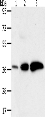 Anti-Human AKR1C1 Antibody - ABMIUM
