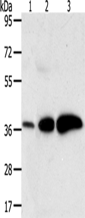Anti-Human AKR1C1 Antibody - ABMIUM