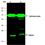 Anti-Human PMVK Antibody [B204]