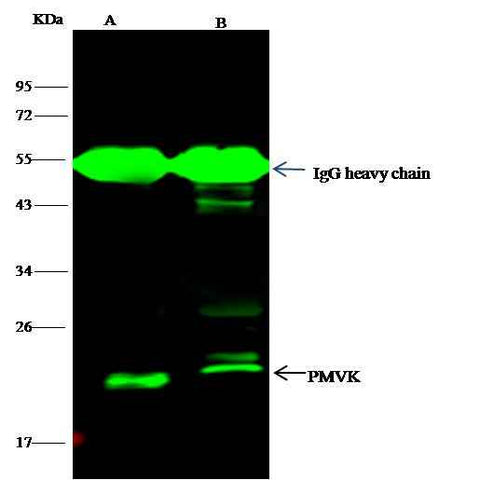 Anti-Human PMVK Antibody [B204] - ABMIUM