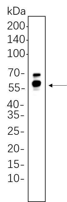 Anti-Human/Mouse/Rat GPER1 Antibody [B624] - ABMIUM