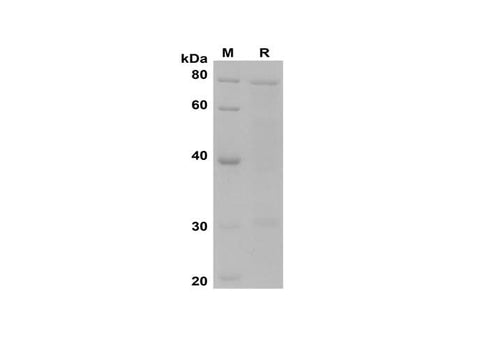 SDS-PAGE analysis of Human PODXL proteins, 2 μg/lane of Recombinant Hunam PODXL proteins was resolved with SDS-PAGE under reducing conditions, showing bands at 78 kDa.