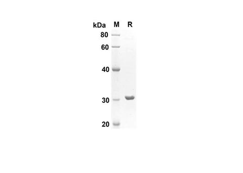 SDS-PAGE analysis of Rat CXCL5 proteins , 2 μg/lane of Recombinant Rat CXCL5 proteins was resolved with SDS-PAGE under reducing conditions , showing bands at 30 kDa.