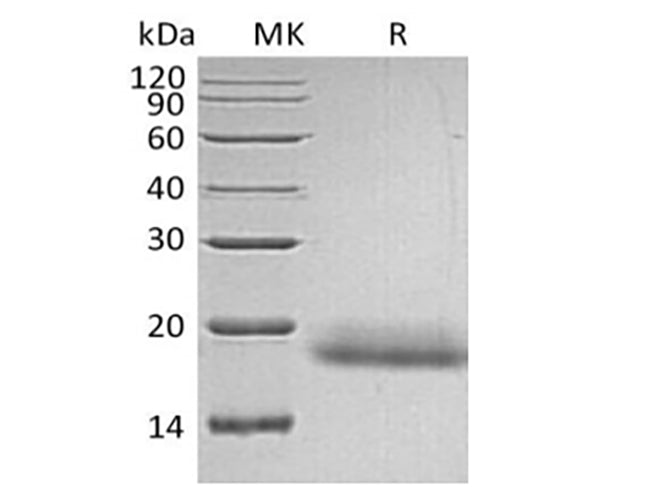 Recombinant Human CD99/MIC2 (C-6His) - ABMIUM