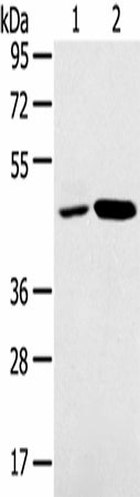 Anti-Human/Mouse/Rat SNX5 Antibody - ABMIUM