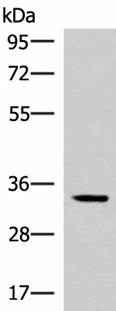 Western blot analysis of Mouse adrenal gland tissue lysate using FOSL2 Polyclonal Antibody at dilution of 1:550