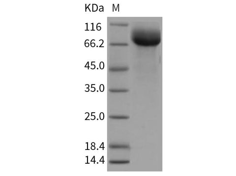 Recombinant Rat HepaCAM2 Protein (Fc Tag) - ABMIUM