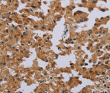 Anti-Human/Mouse/Rat IFRD1 Antibody - ABMIUM