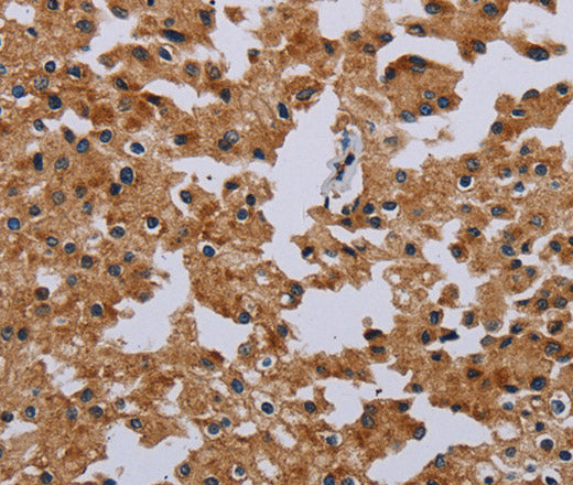 Anti-Human/Mouse/Rat IFRD1 Antibody - ABMIUM