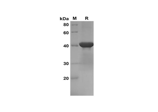 SDS-PAGE analysis of Mouse Cystatin C proteins, 2 μg/lane of Recombinant Mouse Cystatin C proteins was resolved with SDS-PAGE under reducing conditions, showing bands at 41 kDa.