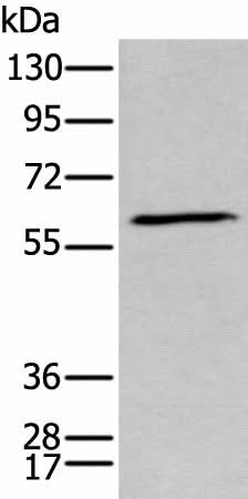 Western blot analysis of Human fetal brain tissue lysate using GPC5 Polyclonal Antibody at dilution of 1:450