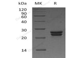 Recombinant Human CDO1 Protein (His Tag) - ABMIUM