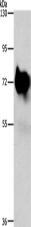 Anti-Human/Mouse/Rat SYN1 Antibody - ABMIUM