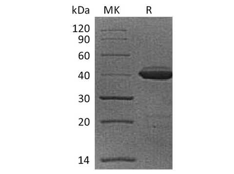 Recombinant Cynomolgus B2M/Beta-2-microglobulin Protein (Fc Tag) - ABMIUM